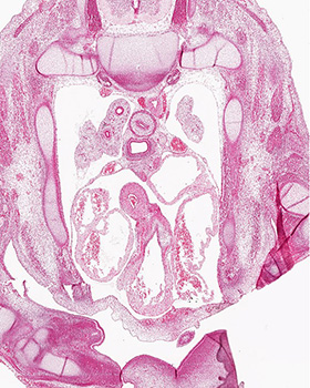 A histology section of a human embryo