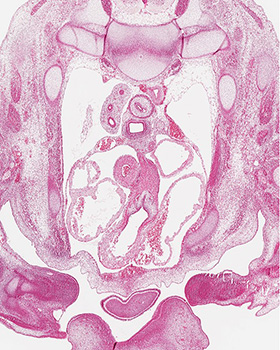 A histology section of a human embryo