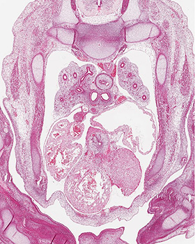 A histology section of a human embryo