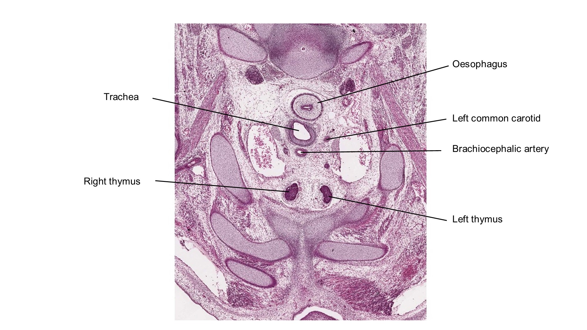 A histology section of a human embryo