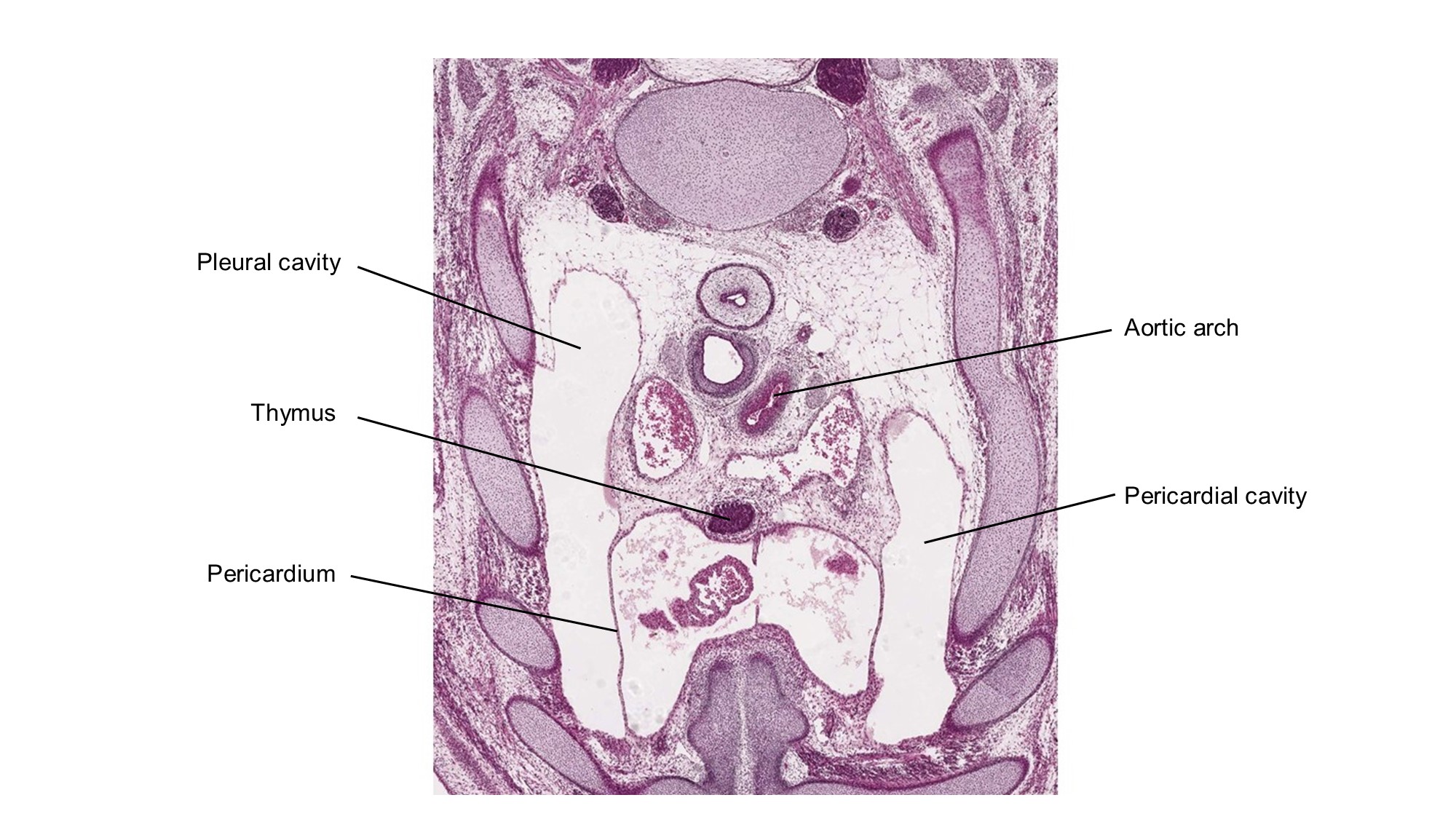 A histology section of a human embryo