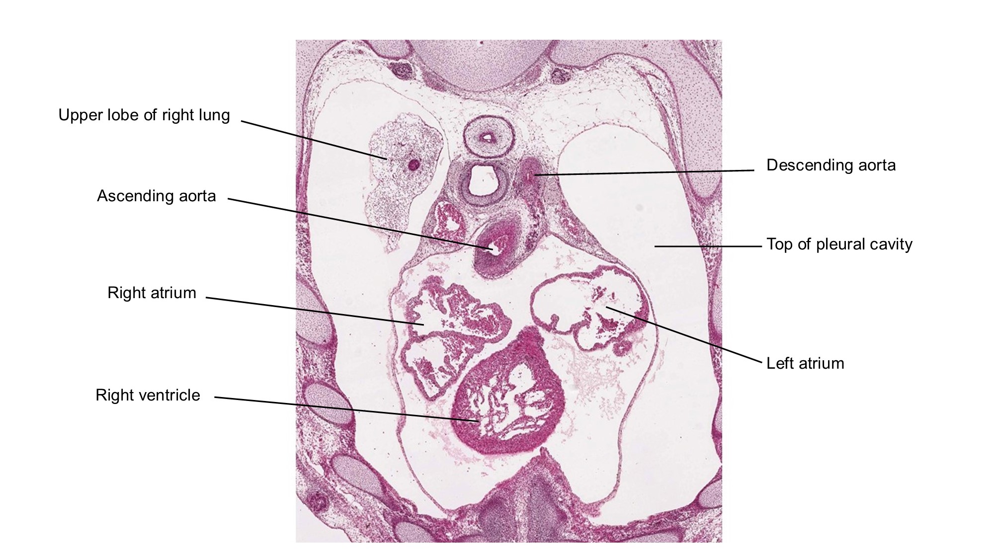 A histology section of a human embryo