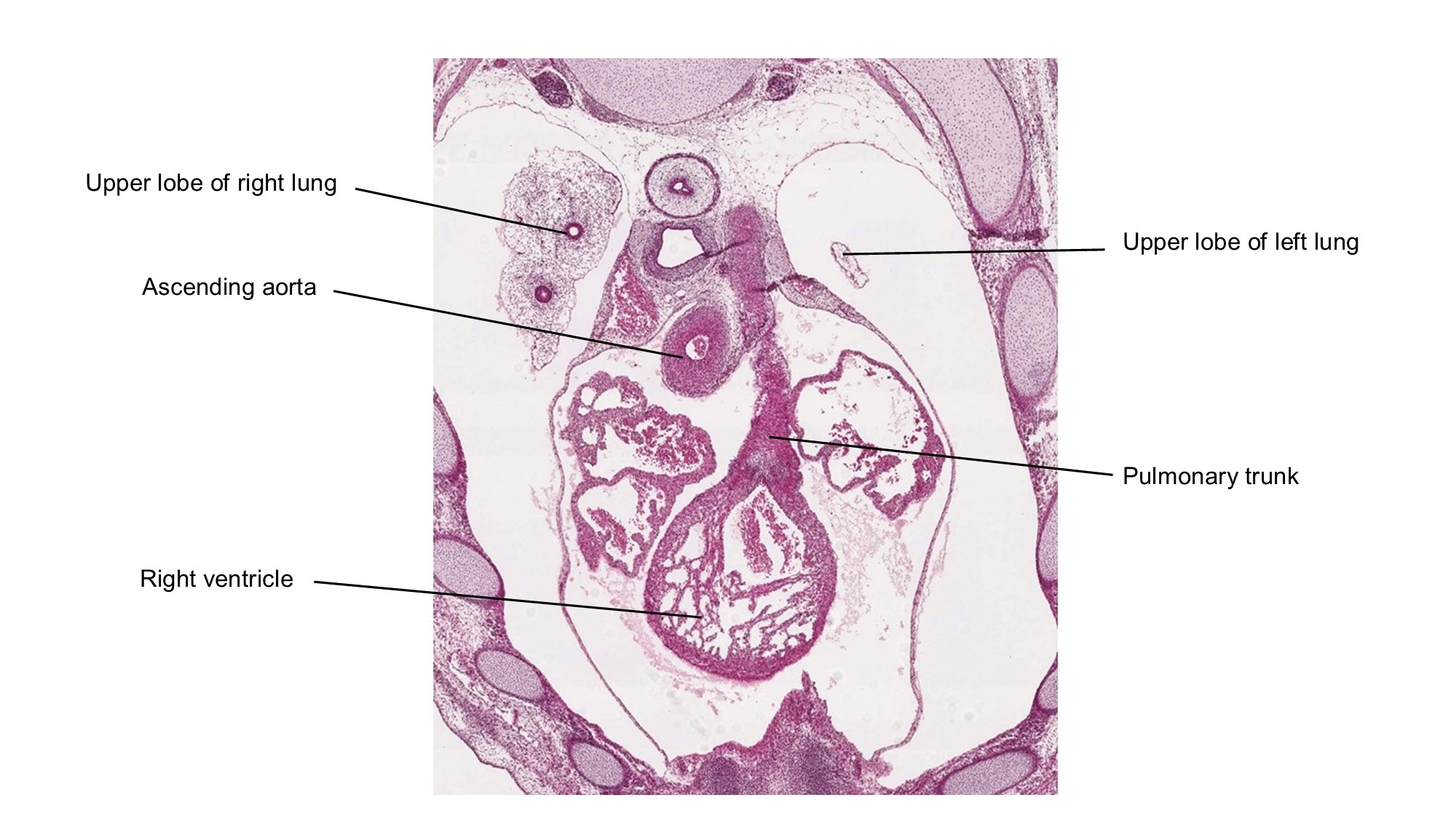 A histology section of a human embryo