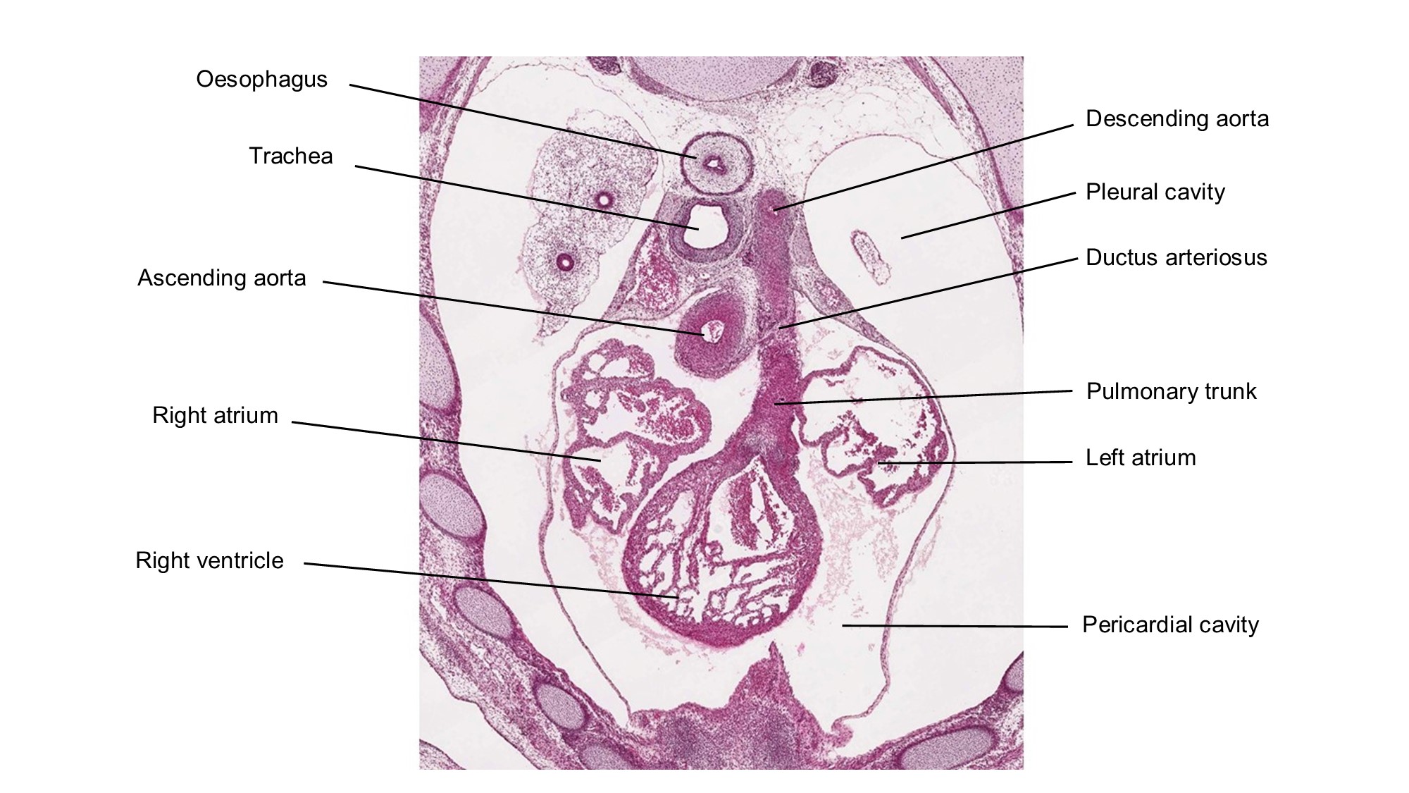 A histology section of a human embryo