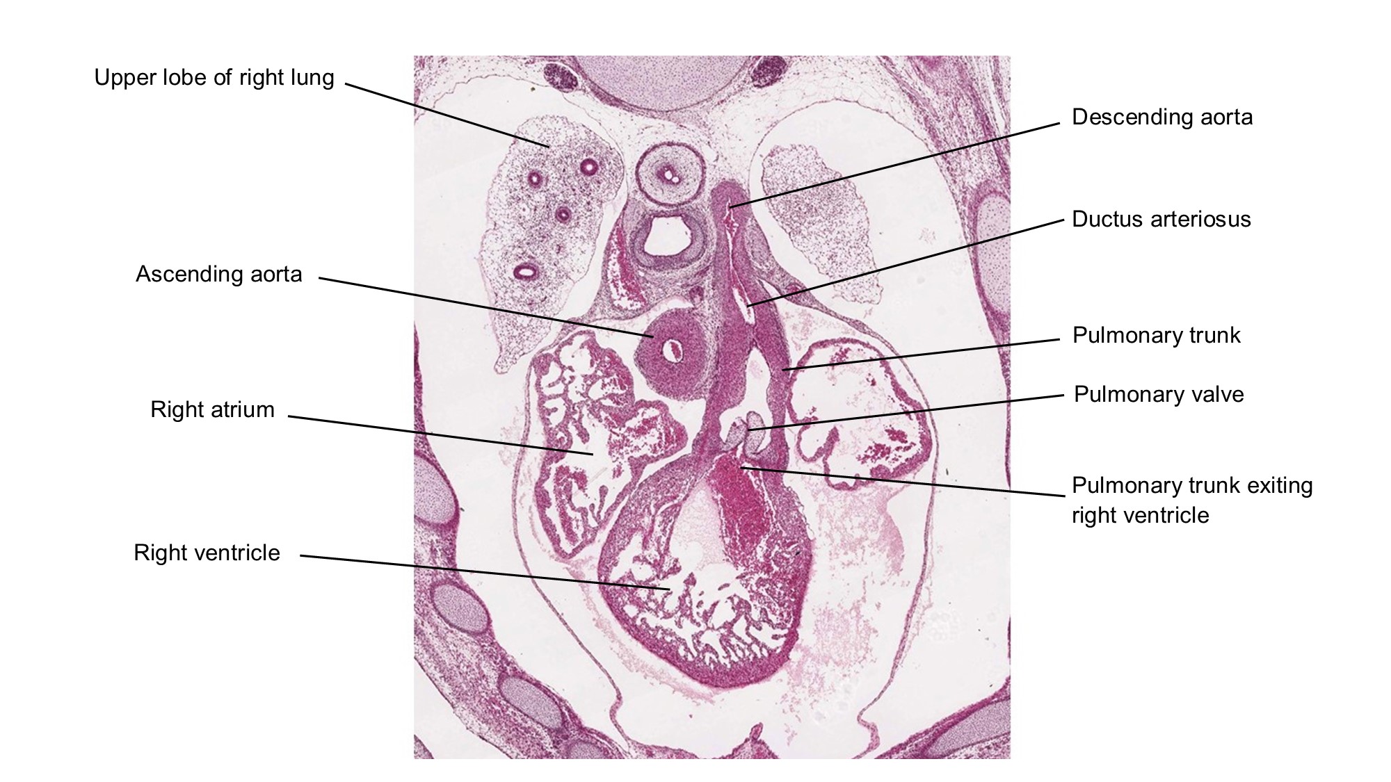 A histology section of a human embryo