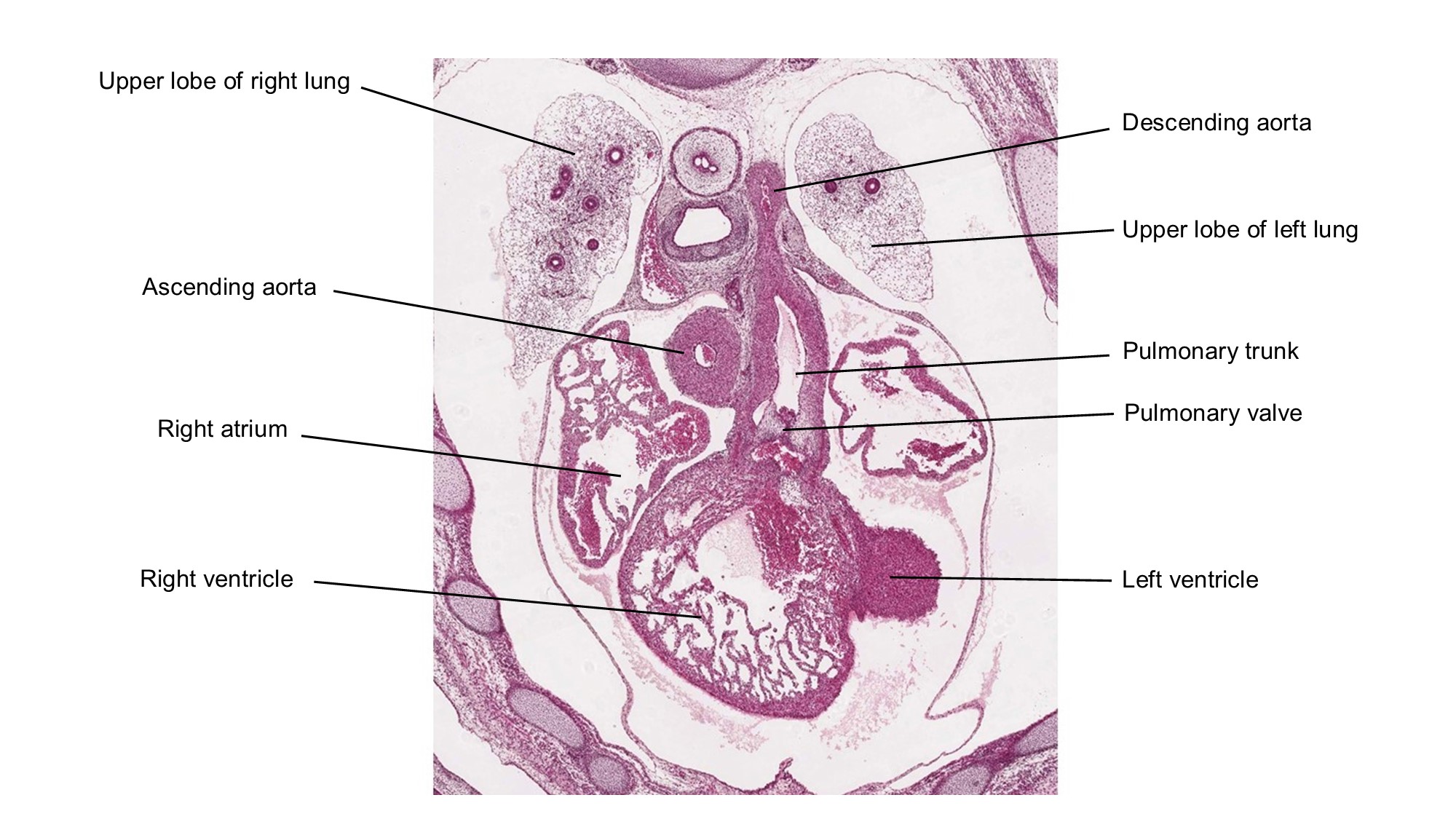A histology section of a human embryo