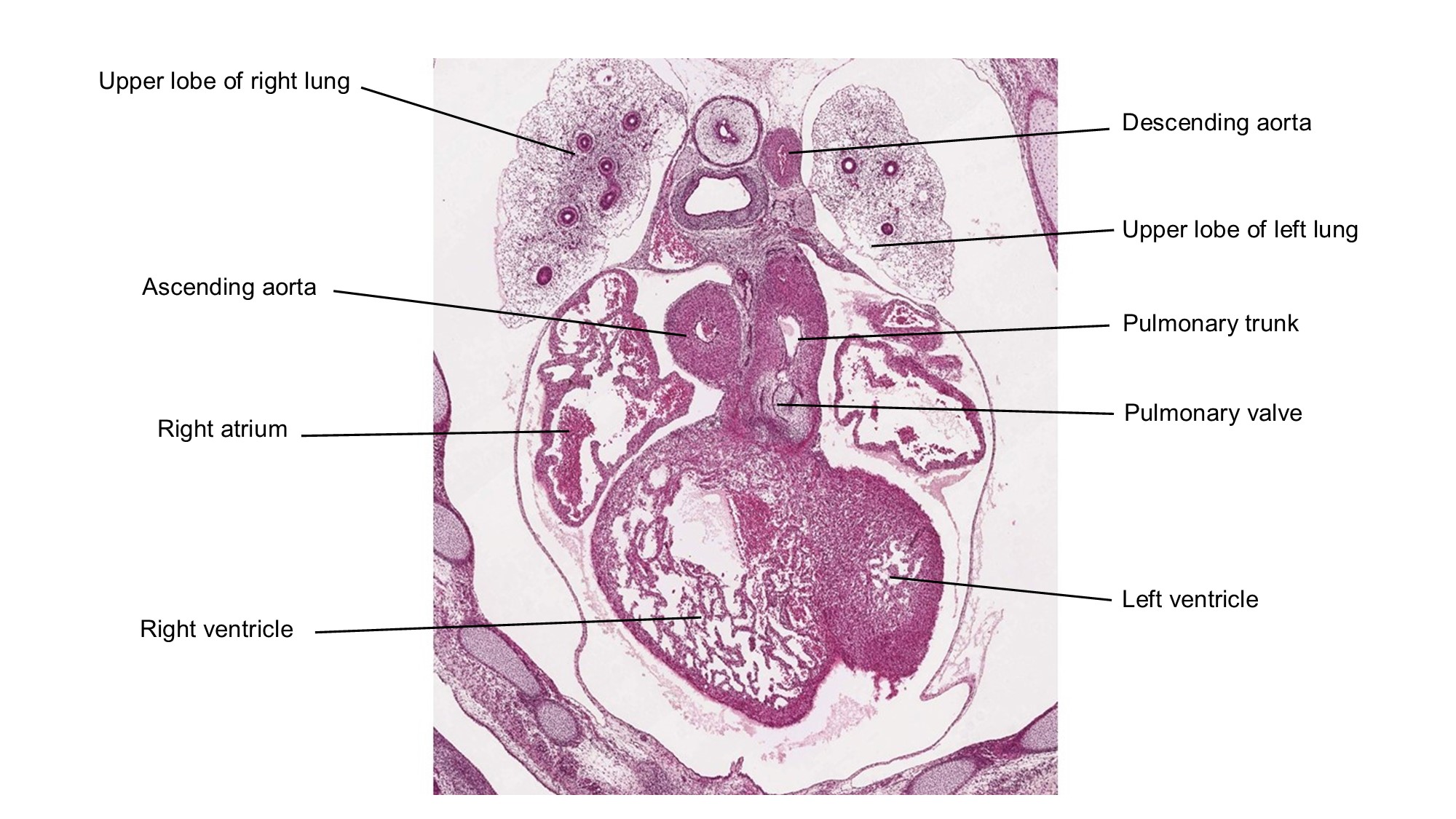 A histology section of a human embryo