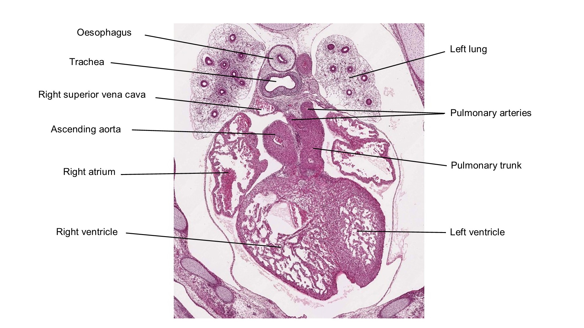 A histology section of a human embryo