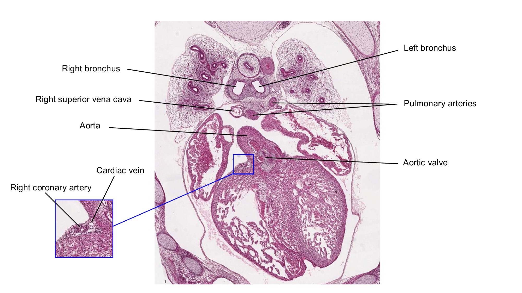 A histology section of a human embryo