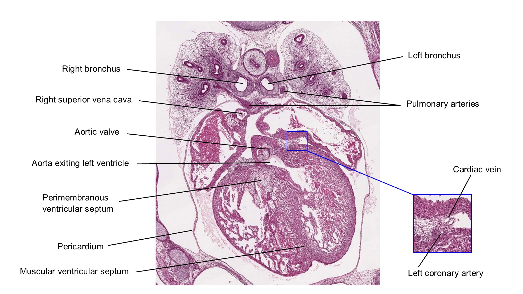A histology section of a human embryo