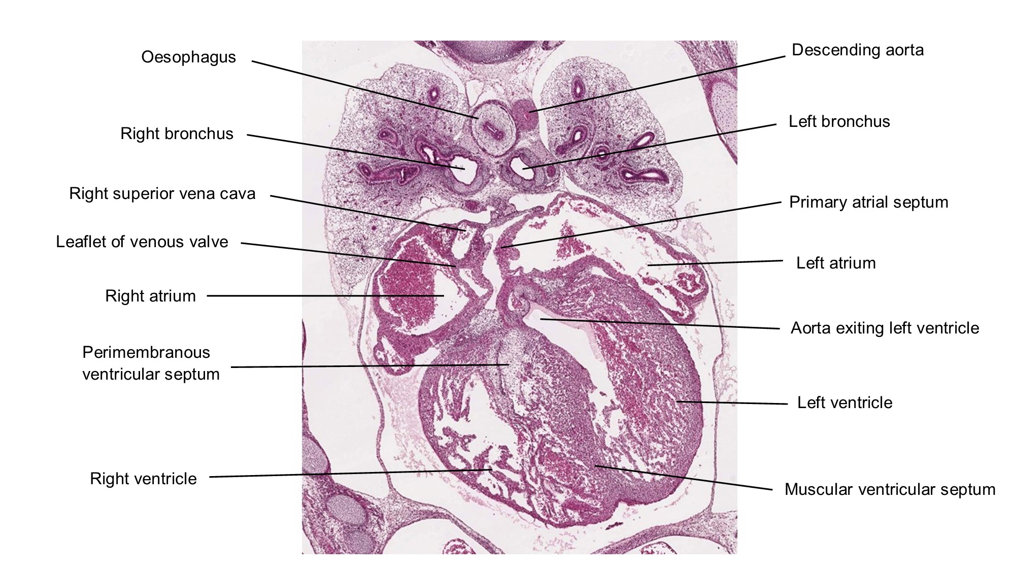 A histology section of a human embryo