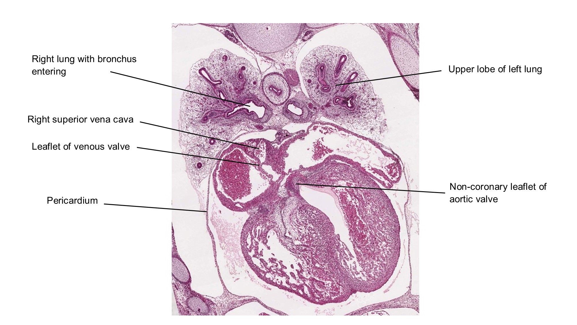 A histology section of a human embryo