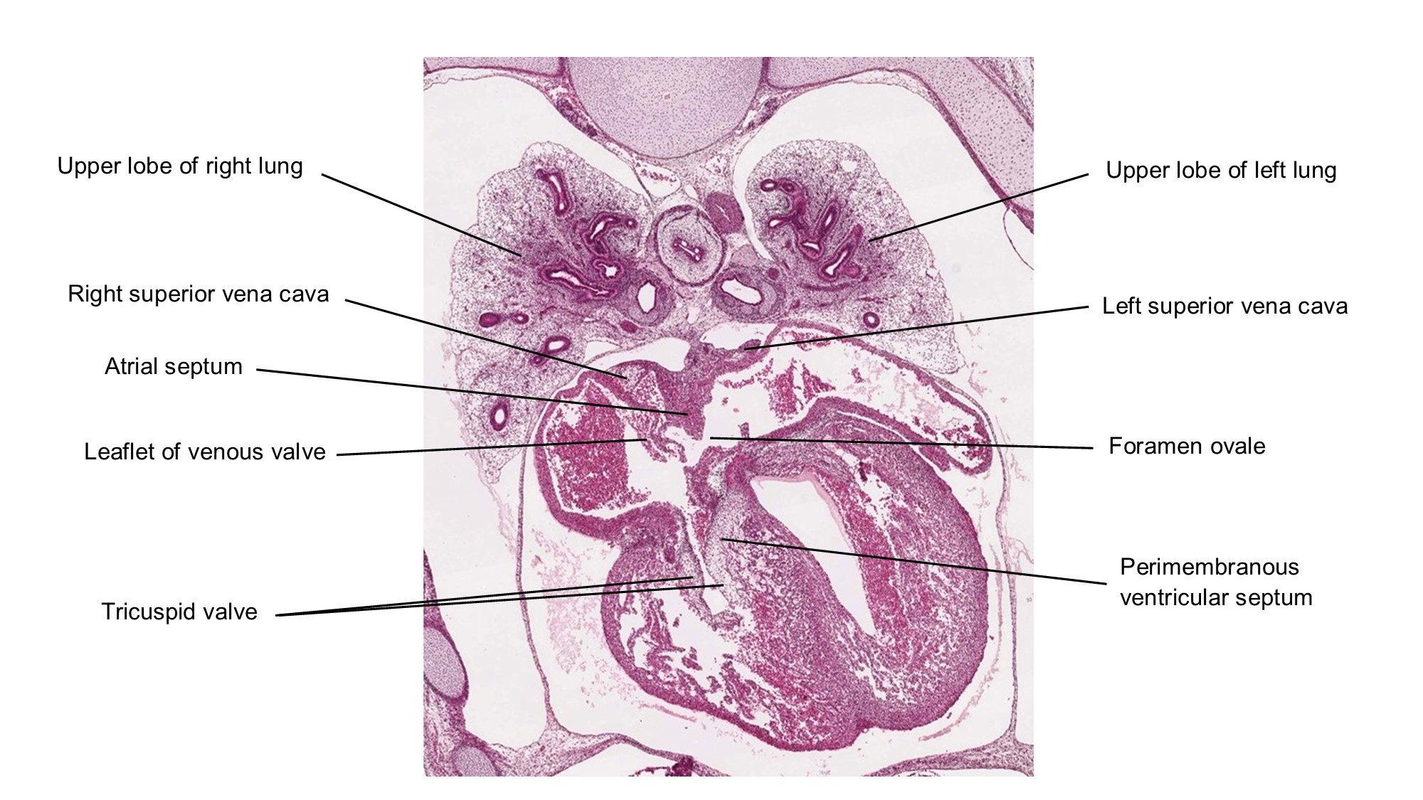 A histology section of a human embryo