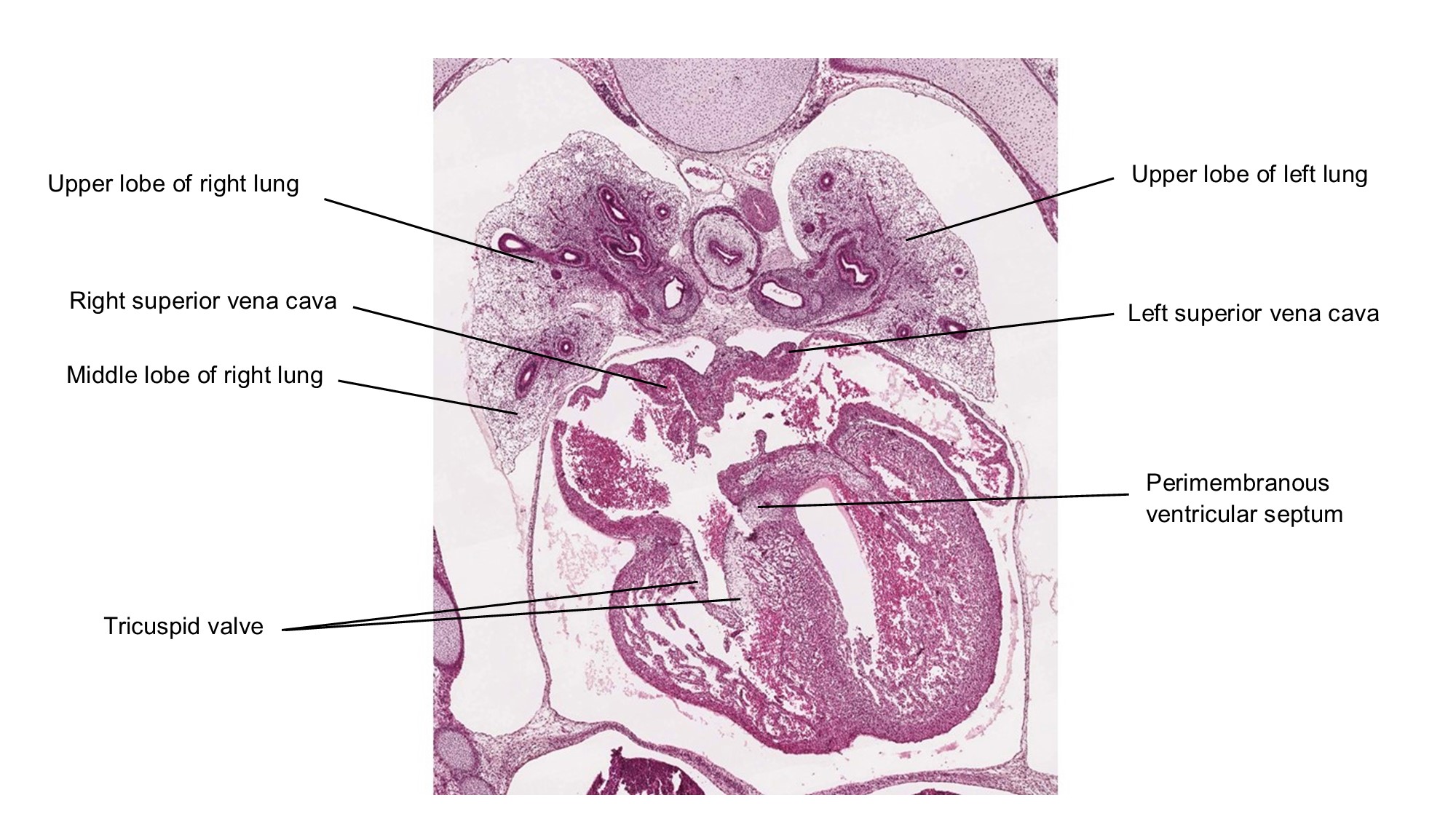 A histology section of a human embryo