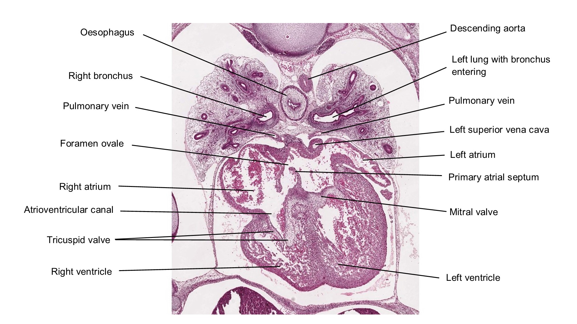 A histology section of a human embryo