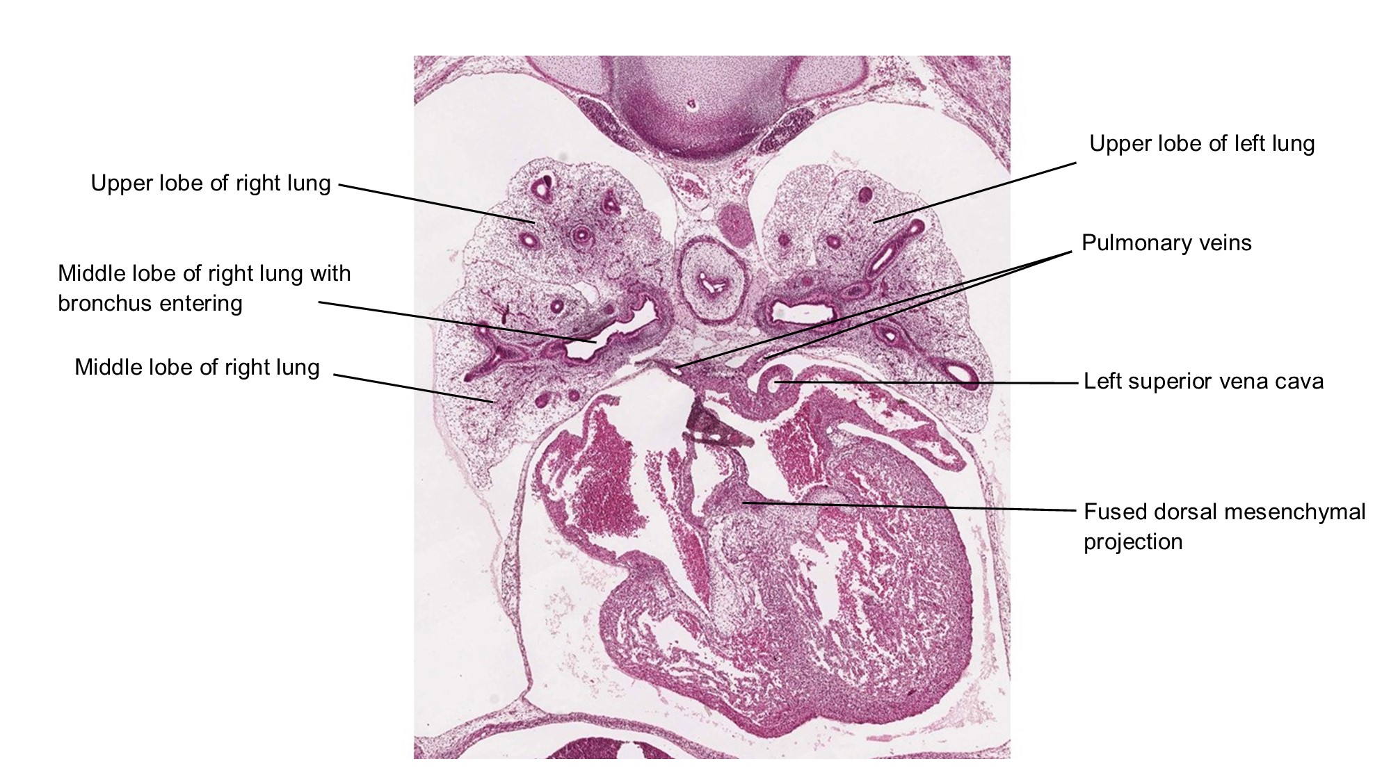 A histology section of a human embryo