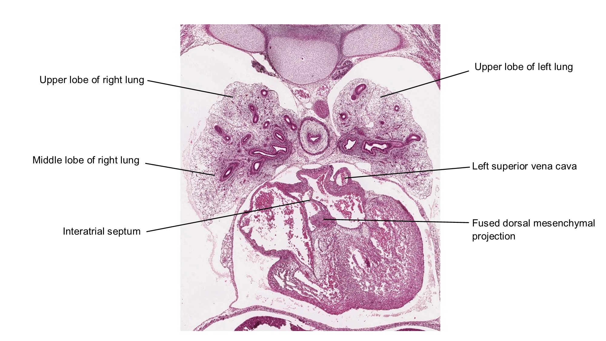 A histology section of a human embryo