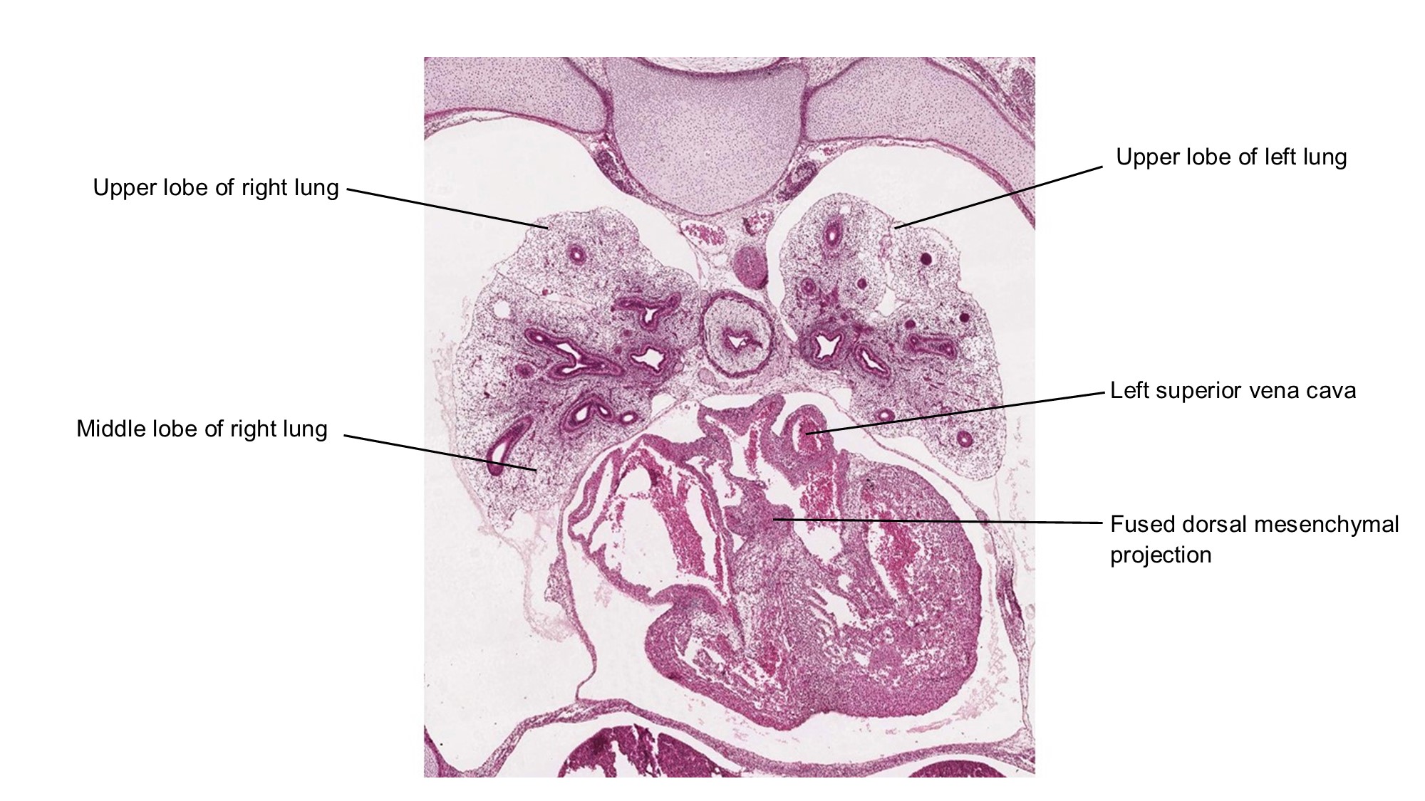 A histology section of a human embryo