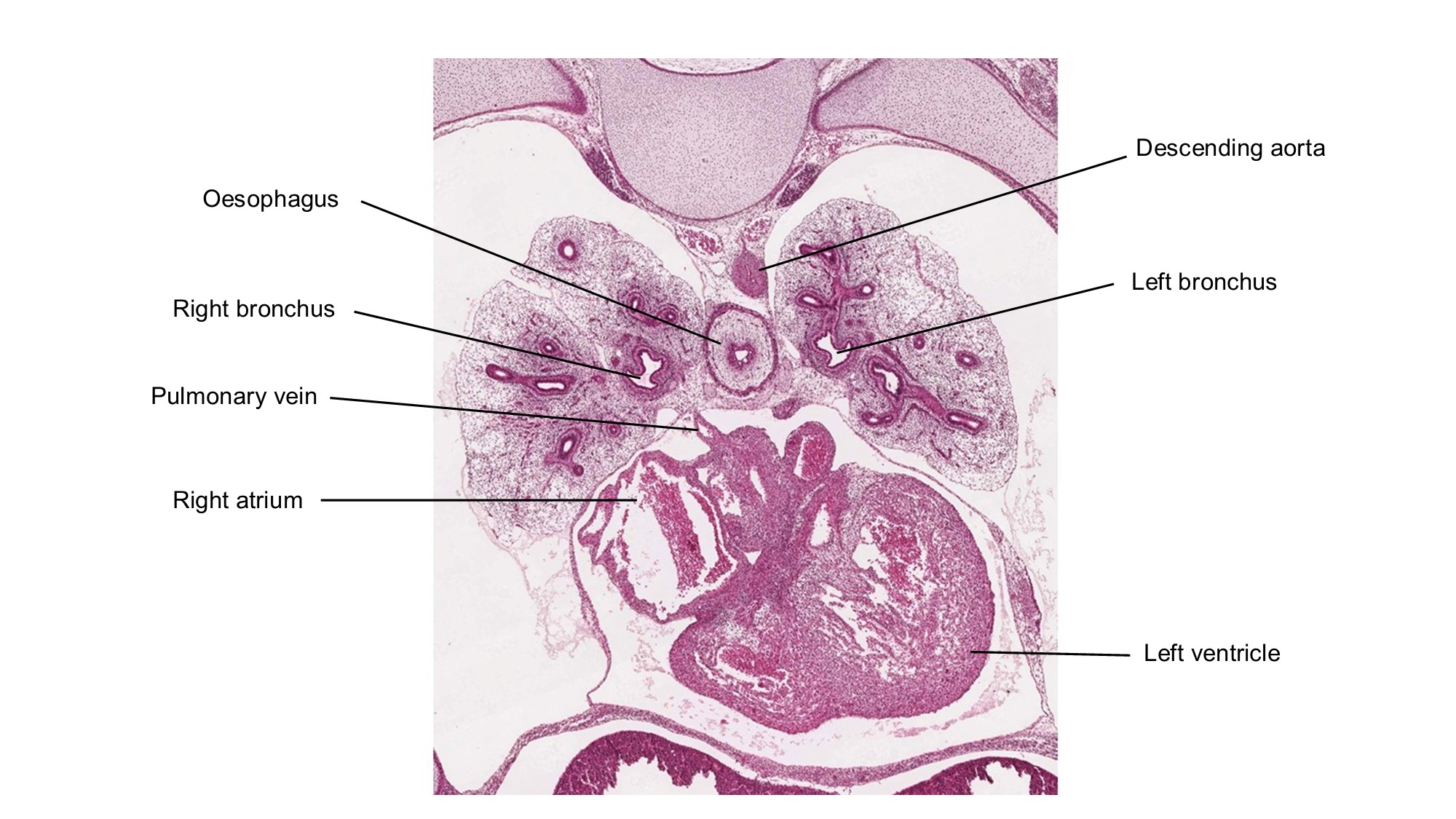 A histology section of a human embryo