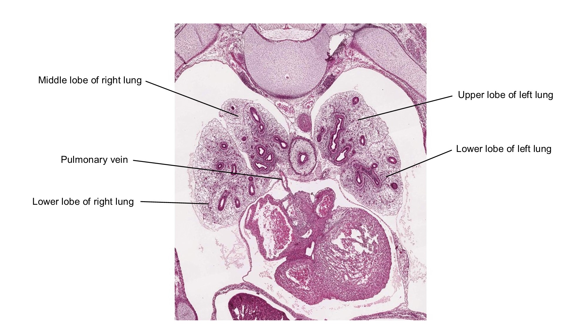 A histology section of a human embryo