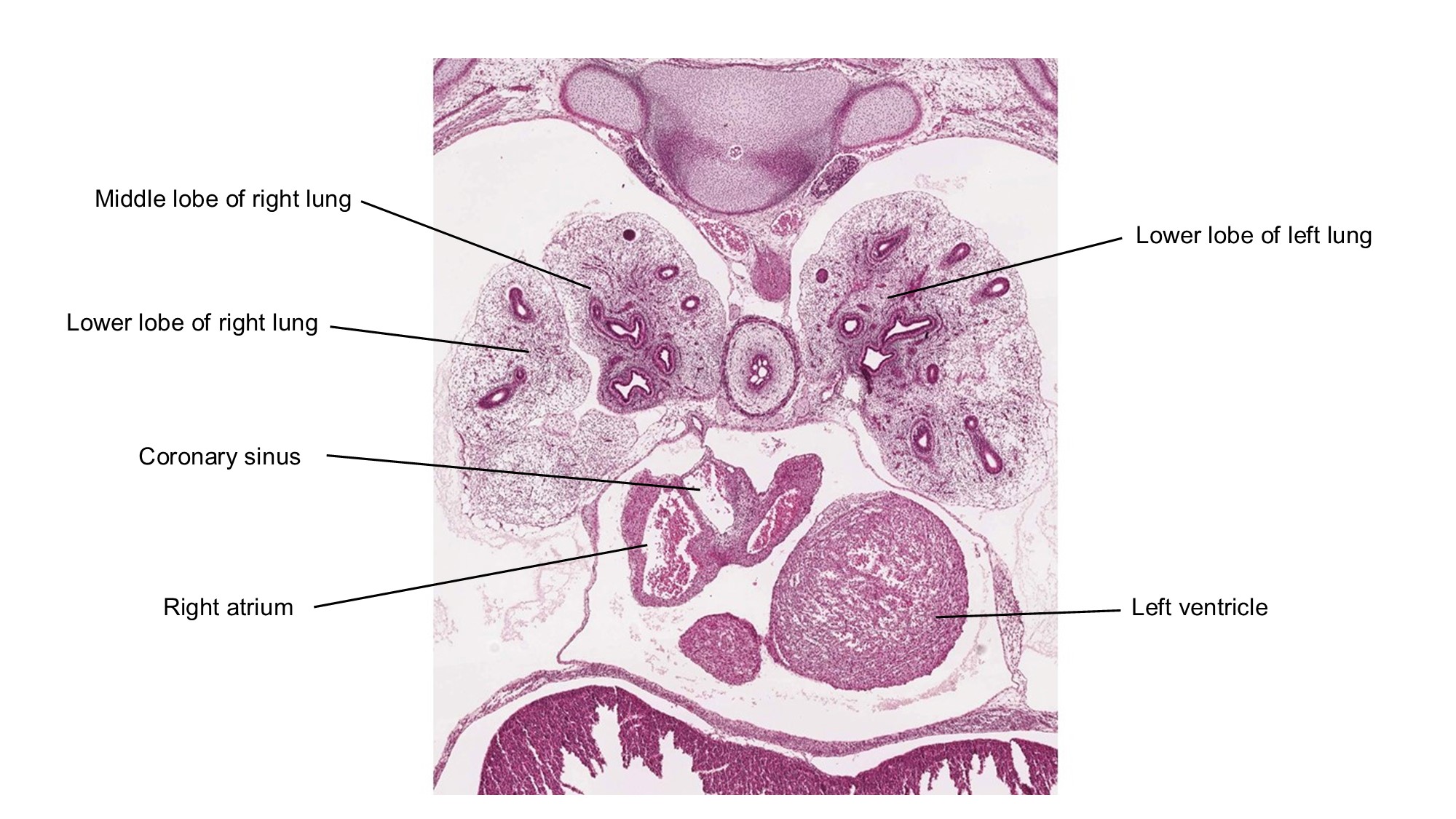A histology section of a human embryo