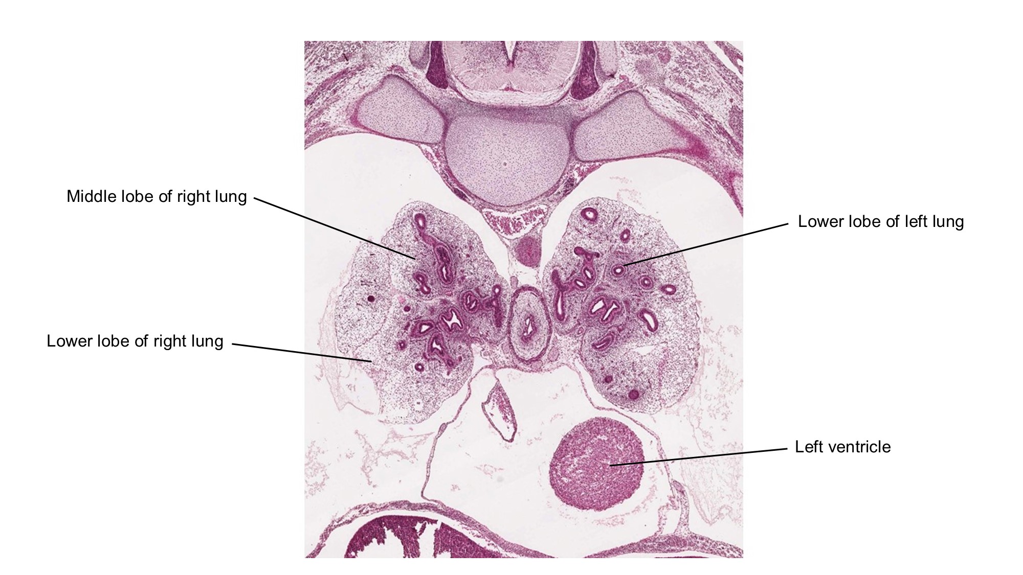 A histology section of a human embryo
