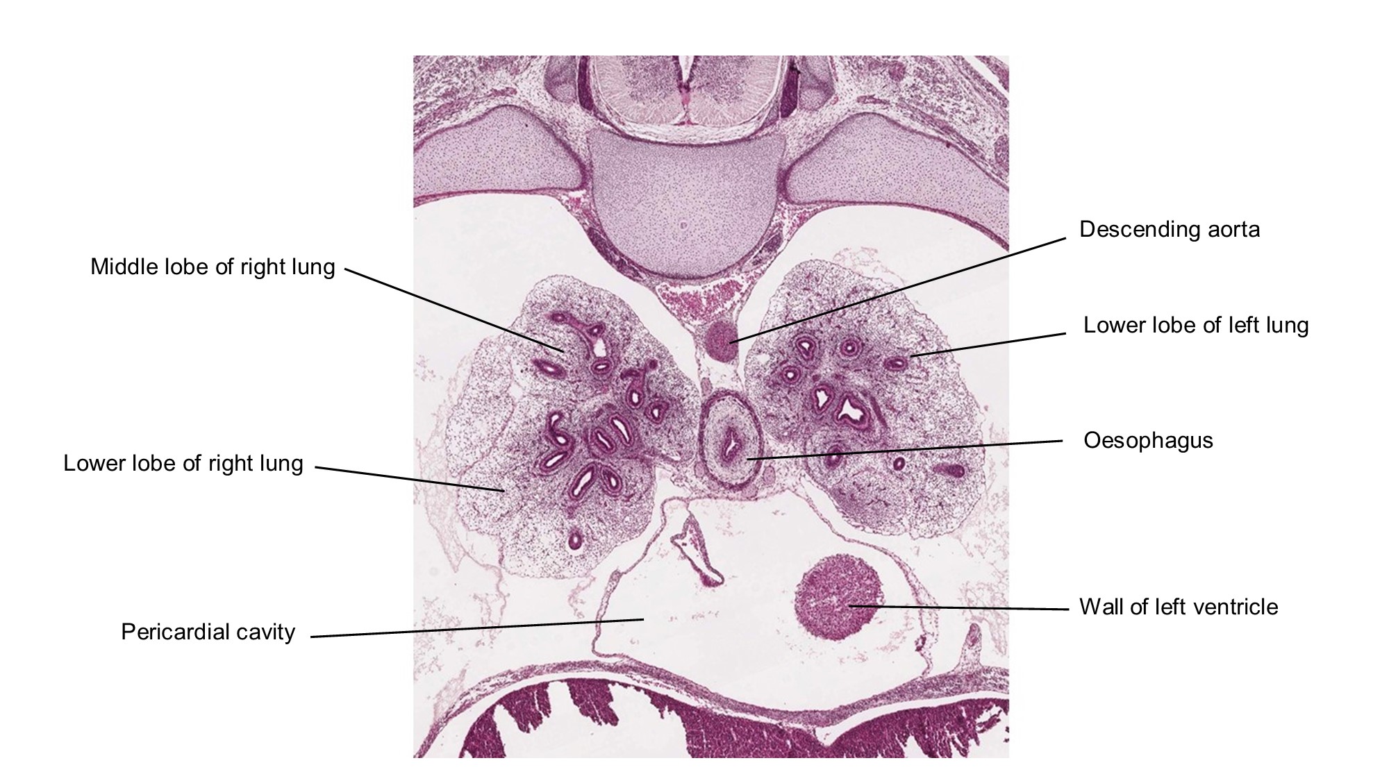A histology section of a human embryo