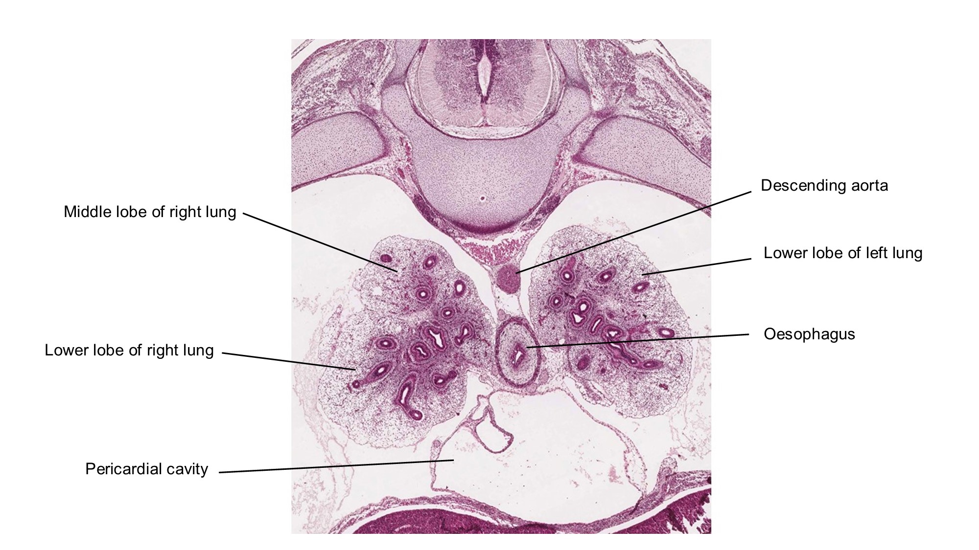 A histology section of a human embryo