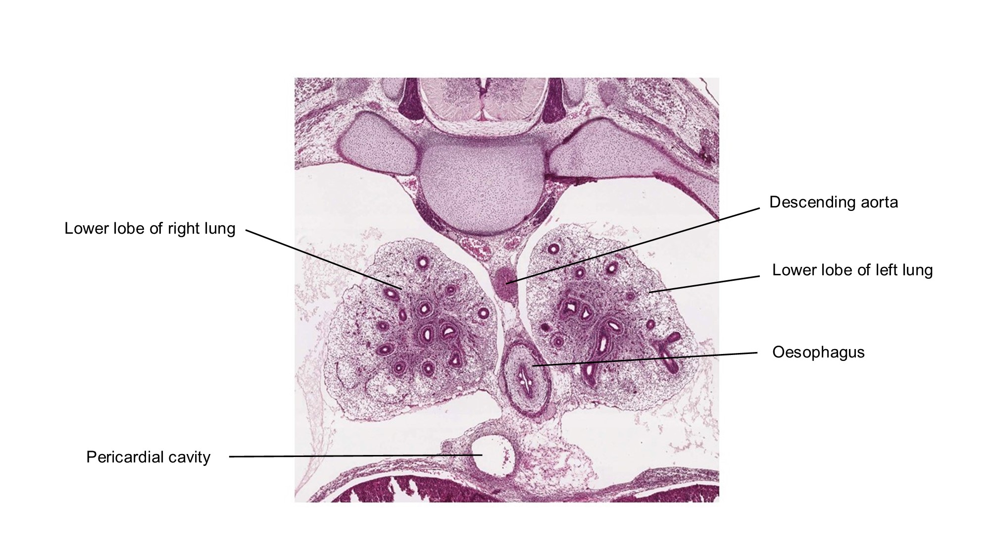 A histology section of a human embryo