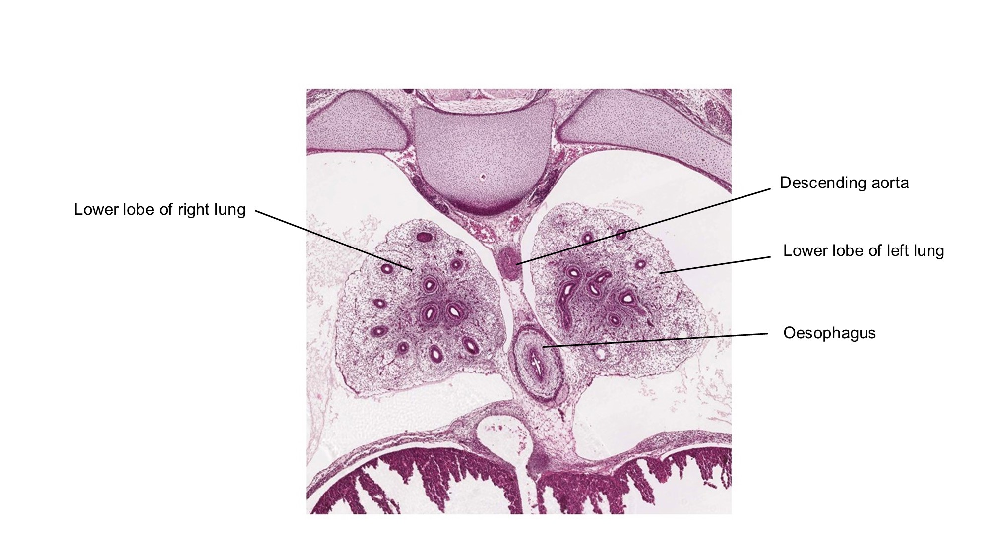 A histology section of a human embryo