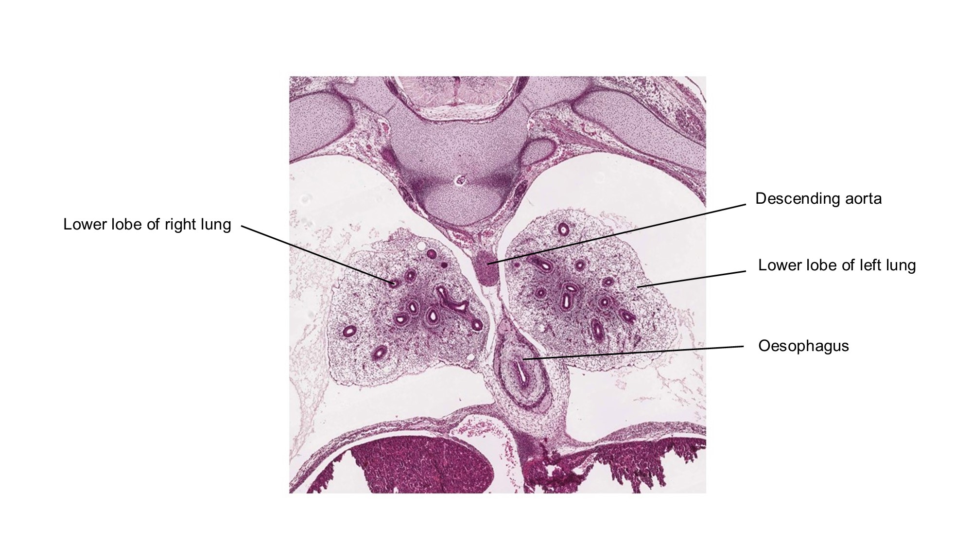 A histology section of a human embryo