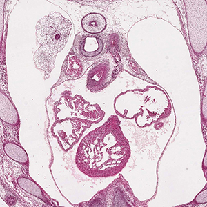 A histology section of a human embryo
