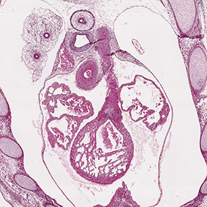 A histology section of a human embryo