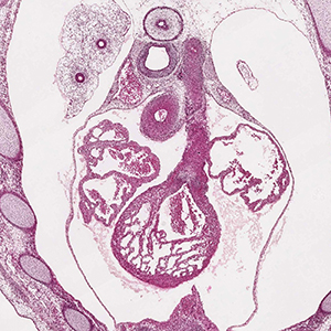 A histology section of a human embryo