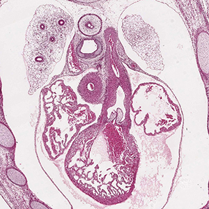 A histology section of a human embryo