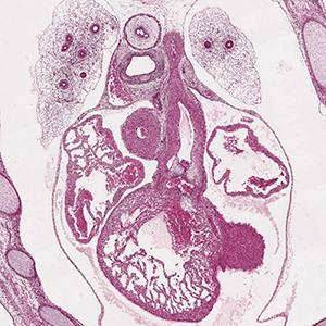 A histology section of a human embryo