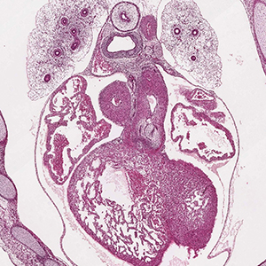 A histology section of a human embryo