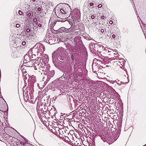 A histology section of a human embryo