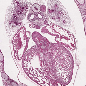 A histology section of a human embryo