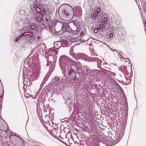 A histology section of a human embryo