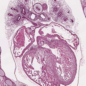 A histology section of a human embryo