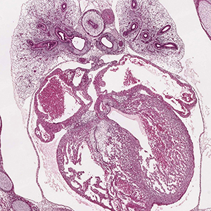A histology section of a human embryo