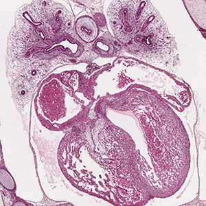 A histology section of a human embryo