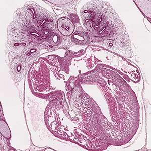 A histology section of a human embryo