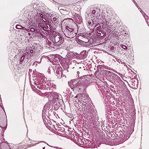 A histology section of a human embryo