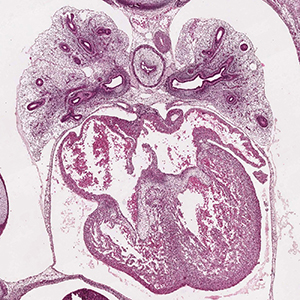 A histology section of a human embryo