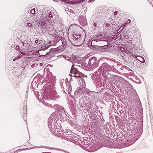 A histology section of a human embryo