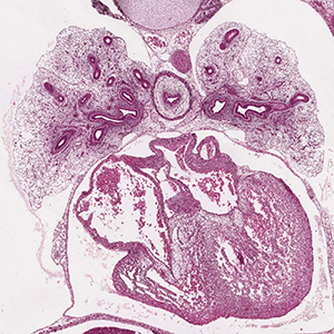 A histology section of a human embryo