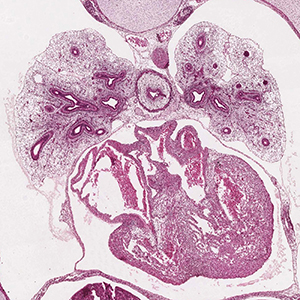 A histology section of a human embryo