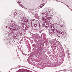 A histology section of a human embryo